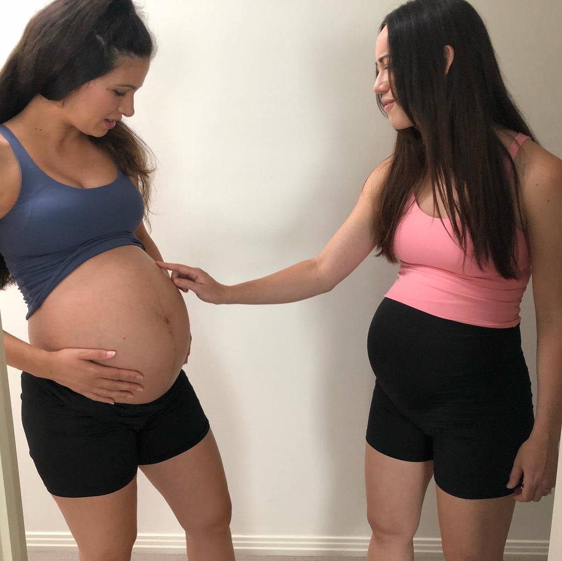 Legs Out, Belly Proud: Why I’m Living in These Shorts